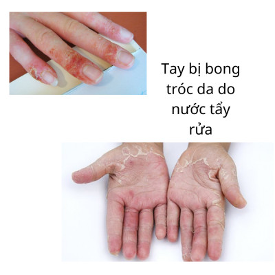 Mua 3 Tặng 2 Đôi Găng Tay Cao Su Tự Nhiên Hàn Quốc Có Móc 31cm