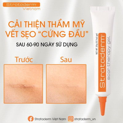 Strataderm Gel Silicone ngăn ngừa sẹo xấu tuýp 20g
